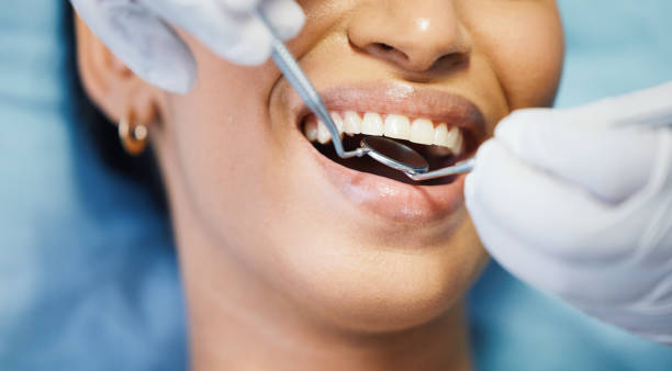 Best Emergency Dental Care for Broken or Chipped Teeth in Eureka Mill, SC